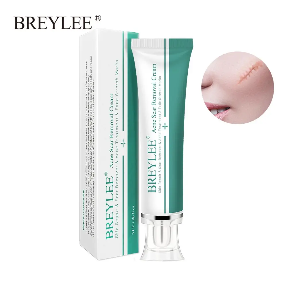 Breylee Acne Scar Removal Cream – 30gm